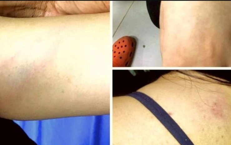 Manipur Girl Beaten