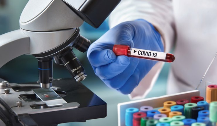 coronavirus testing