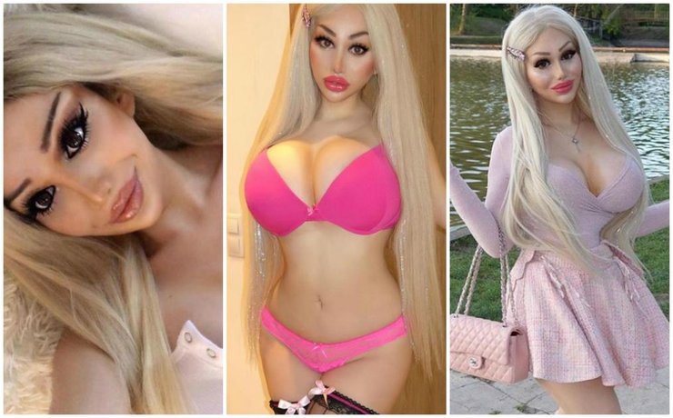 Girl Spends About Rs18 Crore Turning Herself Into A Living Barbie Doll
