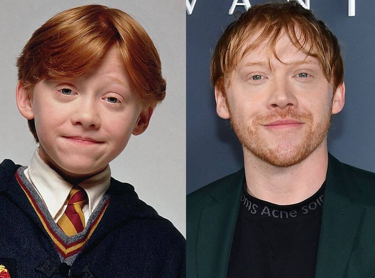 Harry Potter Casts Then And Now Who Is The Most Successful One?